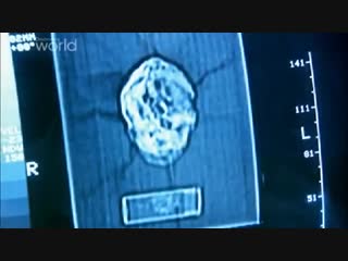 История мумий Самые древние мумии в мире Бездомная мумия